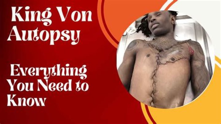 Explore The King Von Autopsy Report